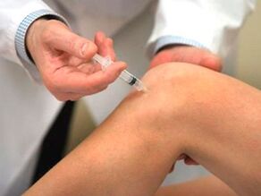 Hogyan kell kezelni a térdízület arthrosist