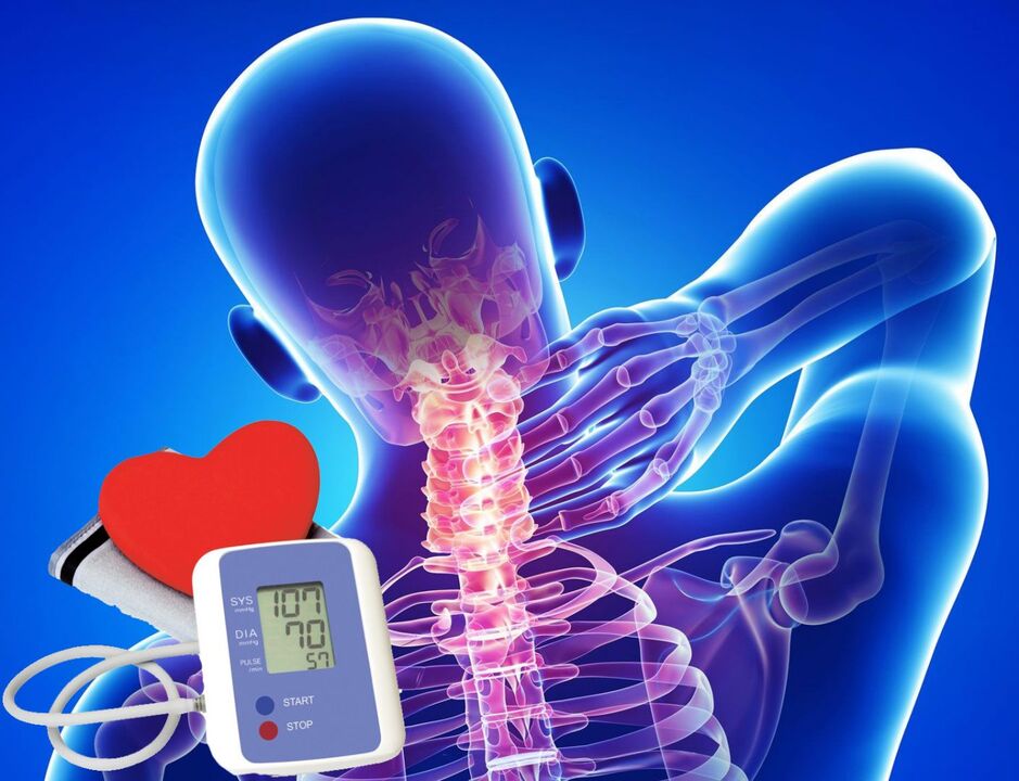 A vérnyomáscsökkentés a méhnyak osteokondrózisához