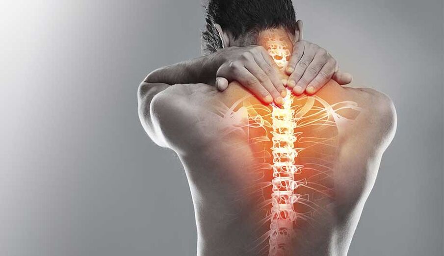 A gerinc fájdalma az osteochondrosis miatt